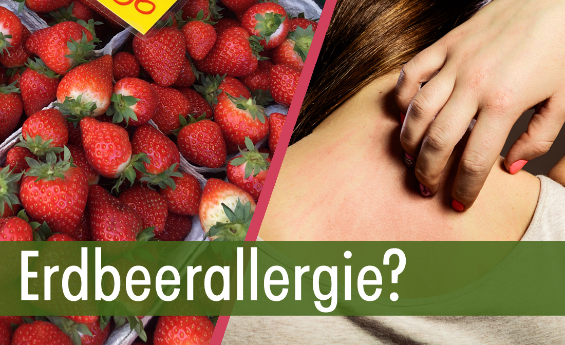 Erdbeerallergie